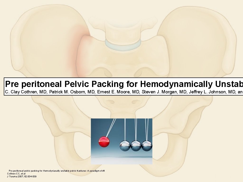 Pre peritoneal Pelvic Packing for Hemodynamically Unstab C. Clay Cothren, MD, Patrick M. Osborn,