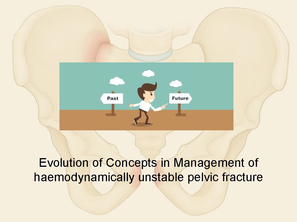 Evolution of Concepts in Management of haemodynamically unstable pelvic fracture 