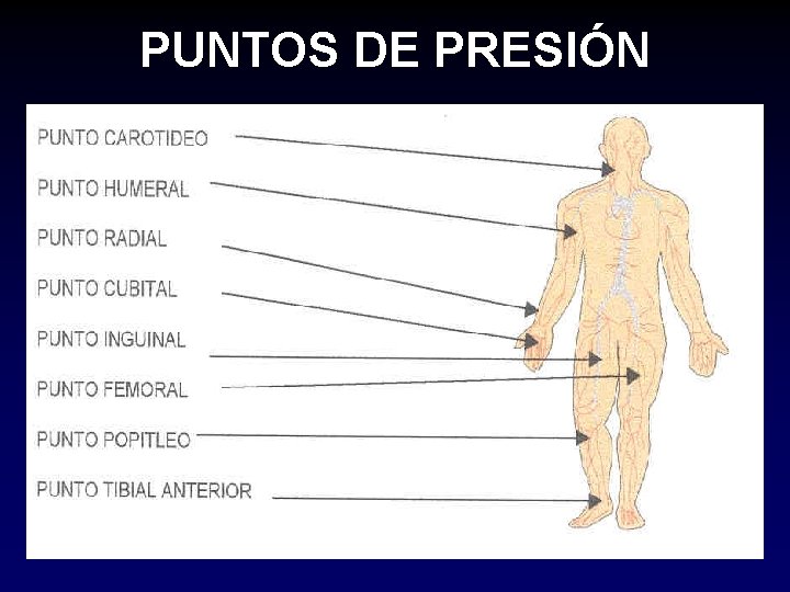 PUNTOS DE PRESIÓN 