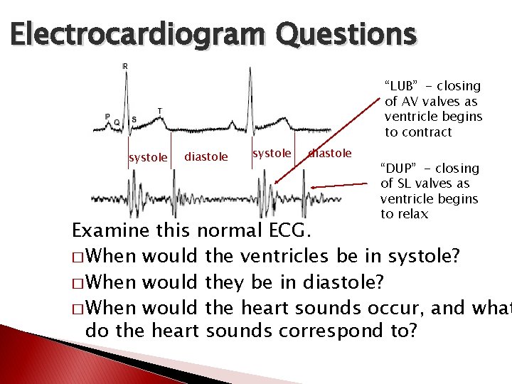Electrocardiogram Questions “LUB” - closing of AV valves as ventricle begins to contract systole Electrocardiogram Questions “LUB” - closing of AV valves as ventricle begins to contract systole