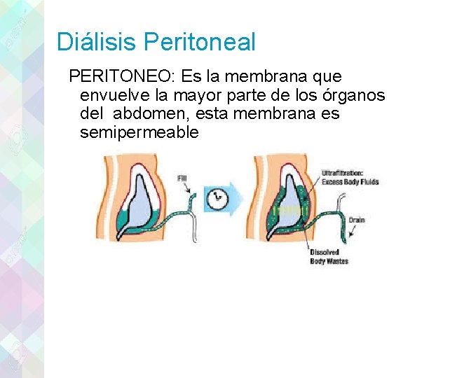 Diálisis Peritoneal PERITONEO: Es la membrana que envuelve la mayor parte de los órganos