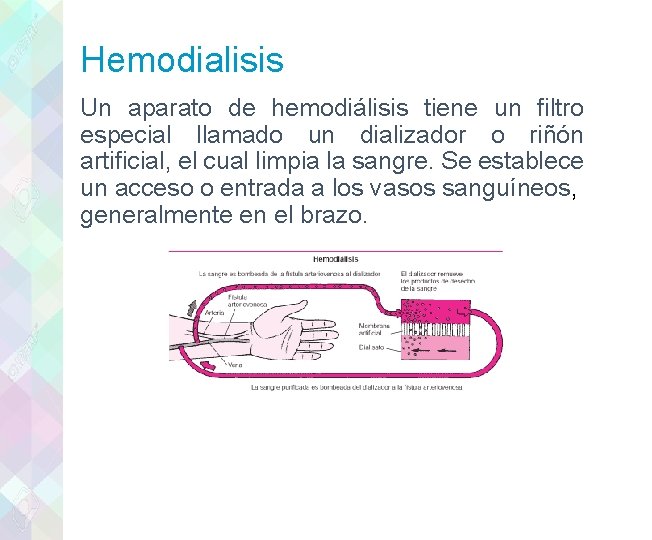 Hemodialisis Un aparato de hemodiálisis tiene un filtro especial llamado un dializador o riñón
