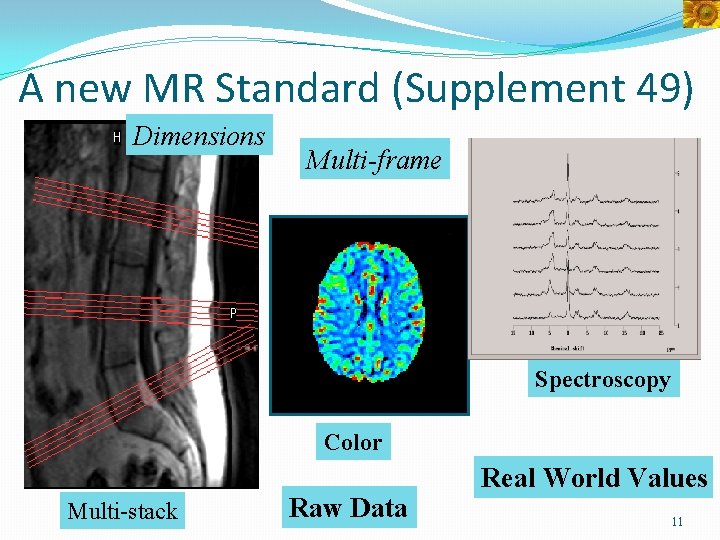 A new MR Standard (Supplement 49) Dimensions Multi-frame Spectroscopy Color Multi-stack Raw Data Real