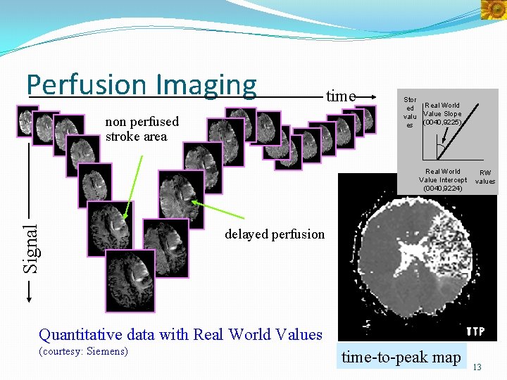 Perfusion Imaging non perfused stroke area time Stor ed valu es Real World Value