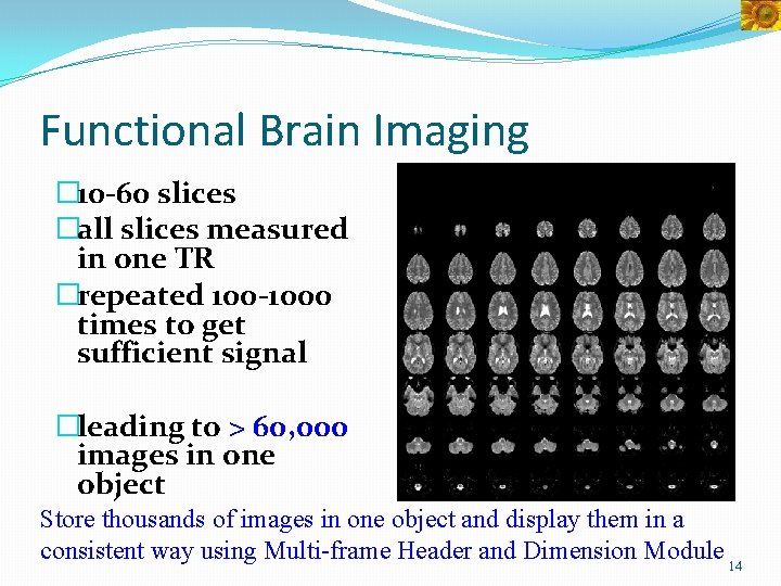 Functional Brain Imaging � 10 -60 slices �all slices measured in one TR �repeated