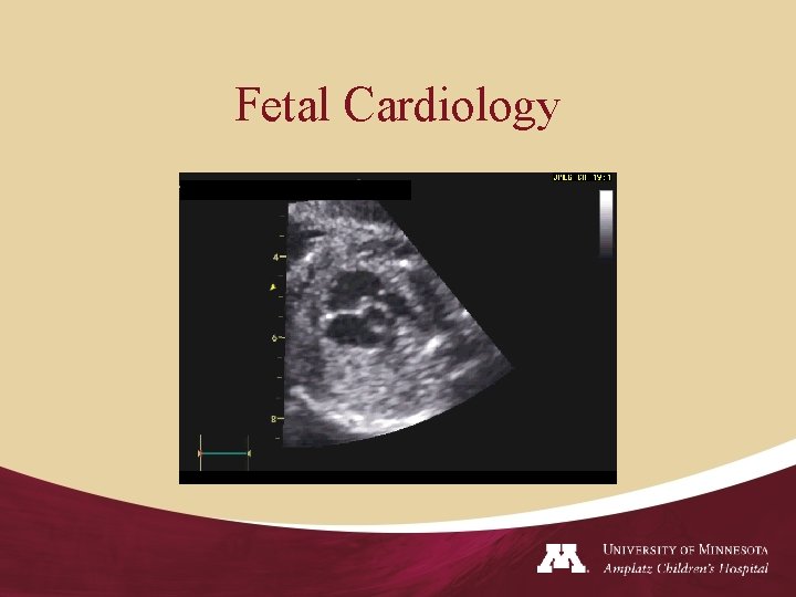 Fetal Cardiology 