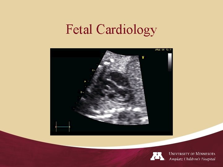 Fetal Cardiology 