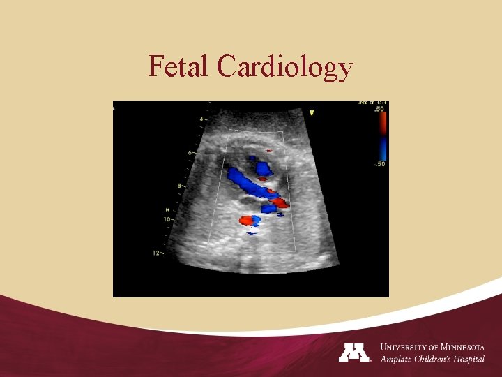 Fetal Cardiology 