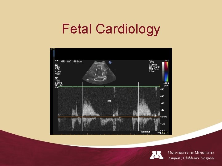 Fetal Cardiology 