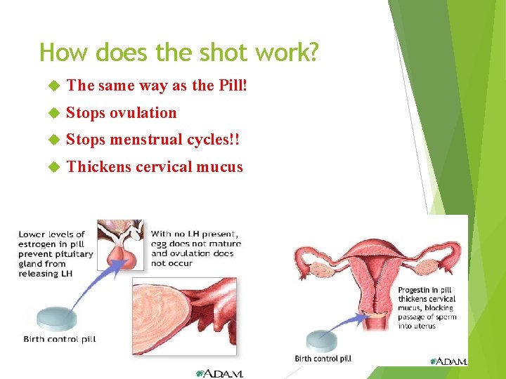 How does the shot work? The same way as the Pill! Stops ovulation Stops