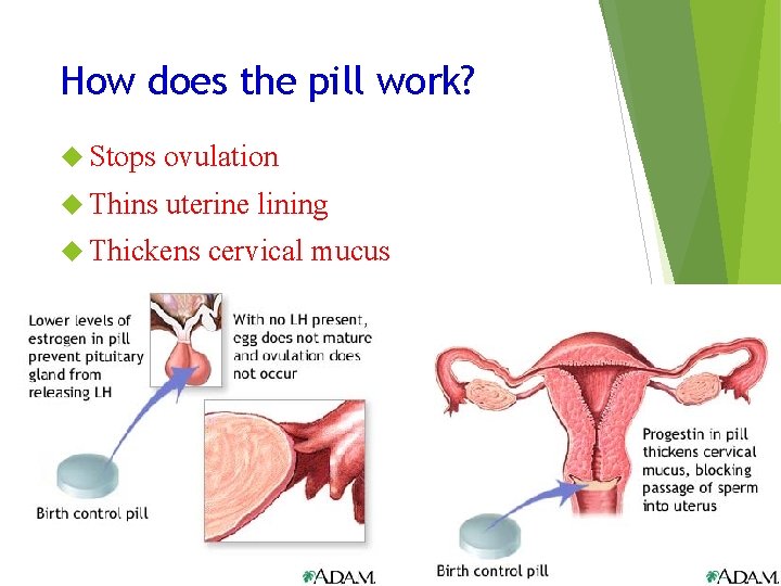 How does the pill work? Stops ovulation Thins uterine lining Thickens cervical mucus 