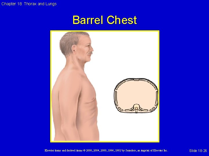 Chapter 18: Thorax and Lungs Barrel Chest Elsevier items and derived items © 2008,