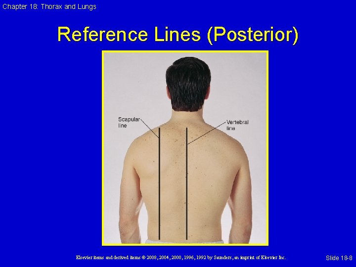 Chapter 18: Thorax and Lungs Reference Lines (Posterior) Elsevier items and derived items ©