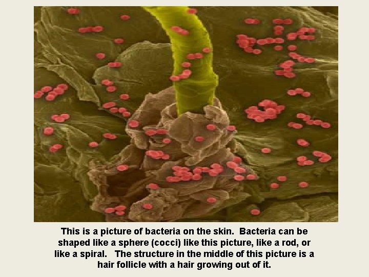 This is a picture of bacteria on the skin. Bacteria can be shaped like