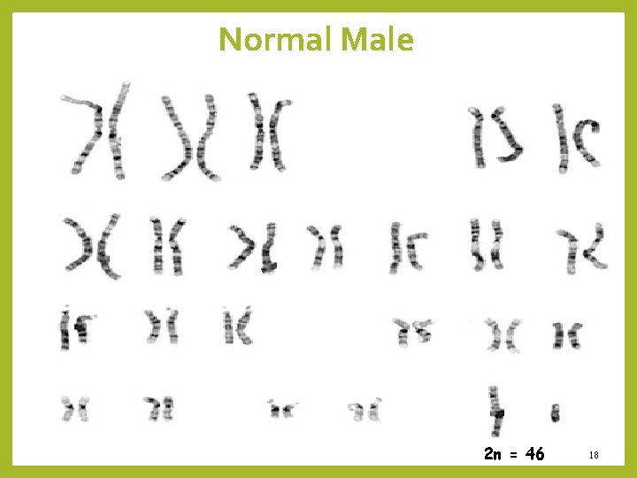 Normal Male 2 n = 46 18 