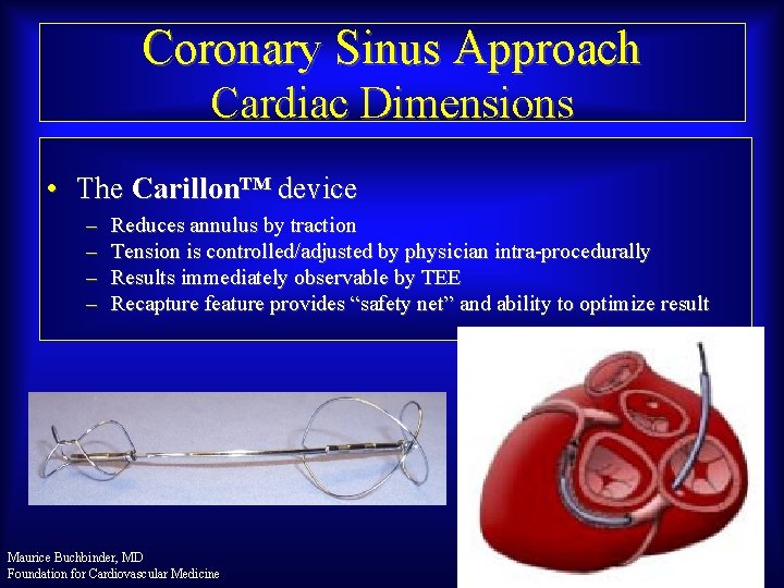 Coronary Sinus Approach Cardiac Dimensions • The Carillon™ device – – Reduces annulus by