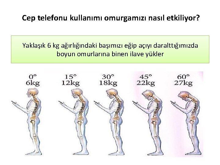 Cep telefonu kullanımı omurgamızı nasıl etkiliyor? Yaklaşık 6 kg ağırlığındaki başımızı eğip açıyı daralttığımızda