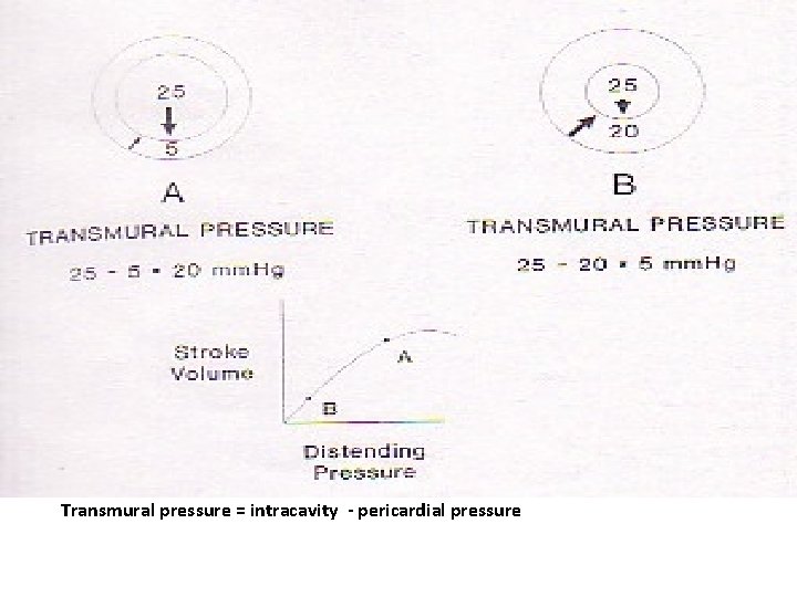 Transmural pressure = intracavity - pericardial pressure 