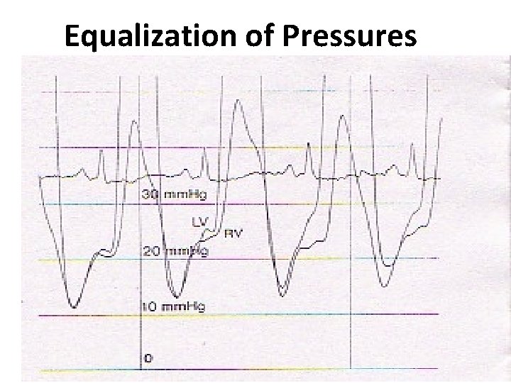 Equalization of Pressures 