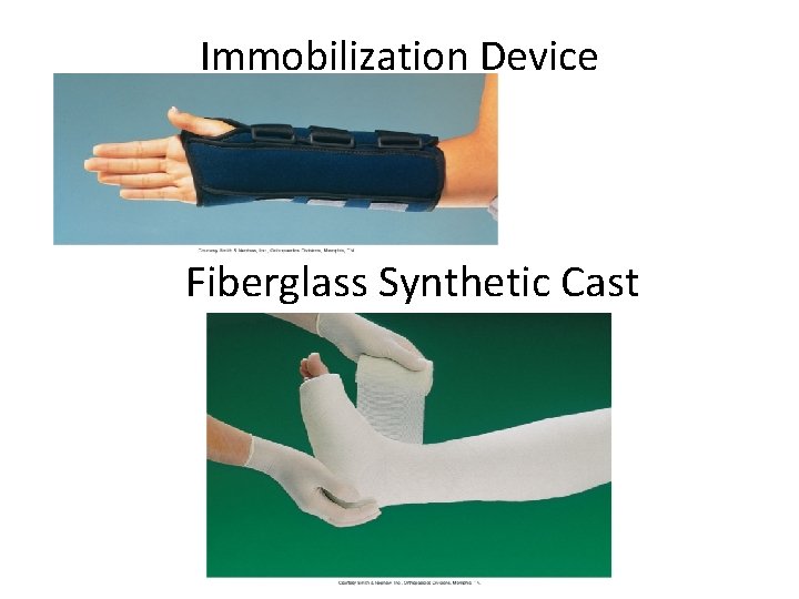Immobilization Device Fiberglass Synthetic Cast 