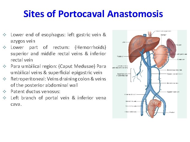 Sites of Portocaval Anastomosis v v v Lower end of esophagus: left gastric vein