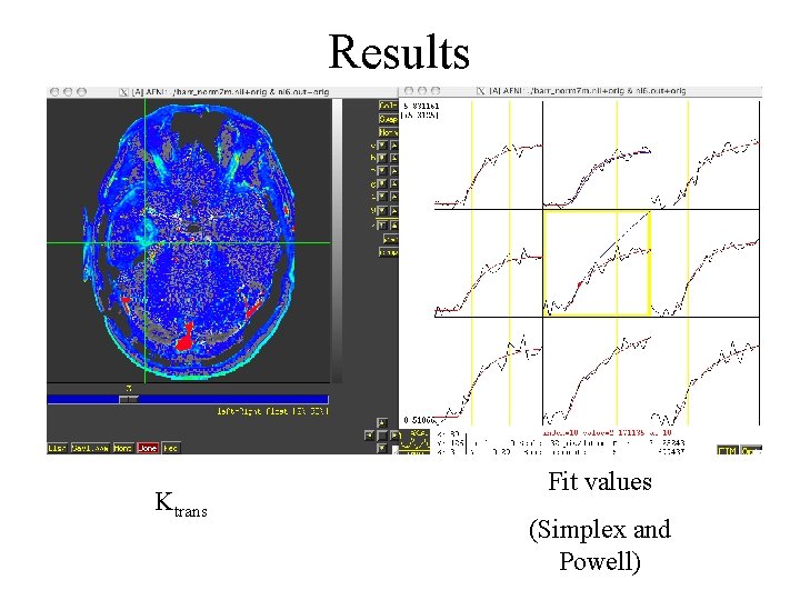 Results Ktrans Fit values (Simplex and Powell) 