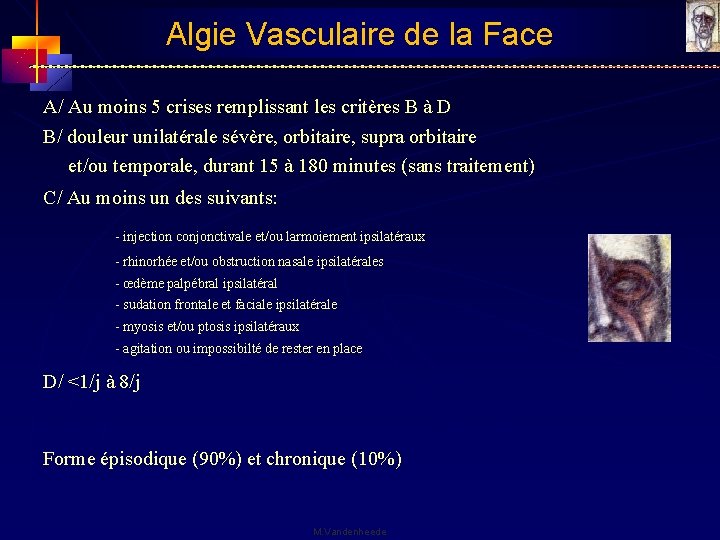 Algie Vasculaire de la Face A/ Au moins 5 crises remplissant les critères B