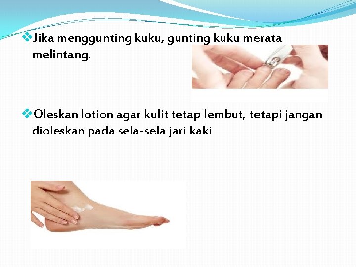 v. Jika menggunting kuku, gunting kuku merata melintang. v. Oleskan lotion agar kulit tetap