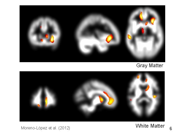 Gray Matter Moreno-López et al. (2012) White Matter 6 