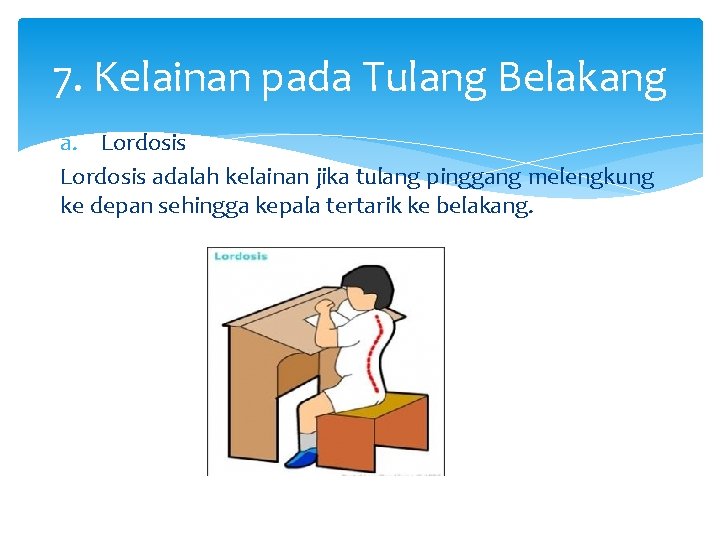 7. Kelainan pada Tulang Belakang a. Lordosis adalah kelainan jika tulang pinggang melengkung ke