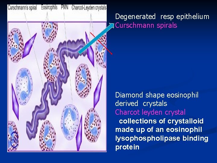 Degenerated resp epithelium Curschmann spirals Diamond shape eosinophil derived crystals Charcot leyden crystal collections