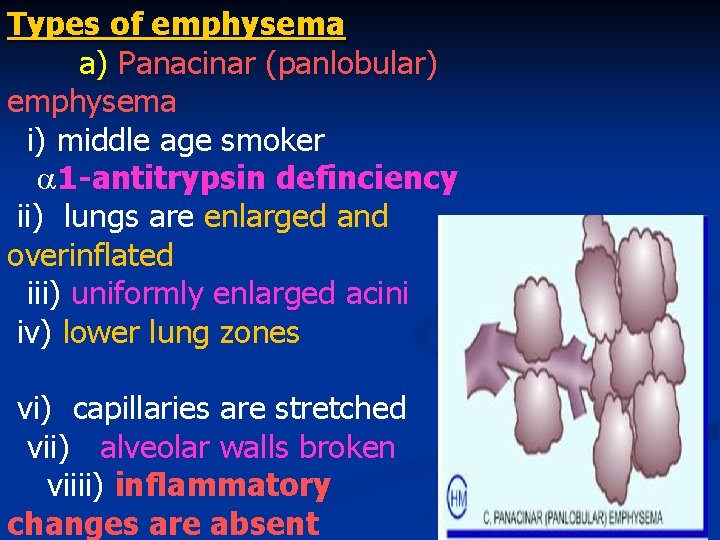 Types of emphysema a) Panacinar (panlobular) emphysema i) middle age smoker 1 -antitrypsin definciency