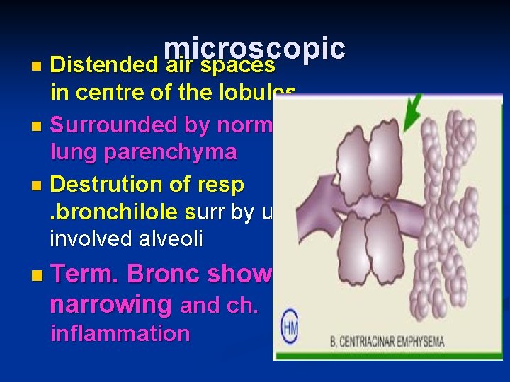 microscopic n Distended air spaces in centre of the lobules n Surrounded by normal