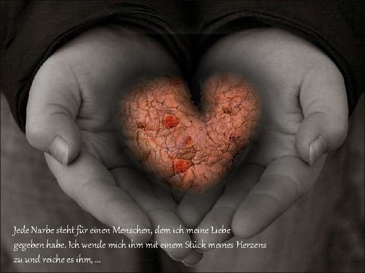 Jede Narbe steht für einen Menschen, dem ich meine Liebe gegeben habe. Ich wende