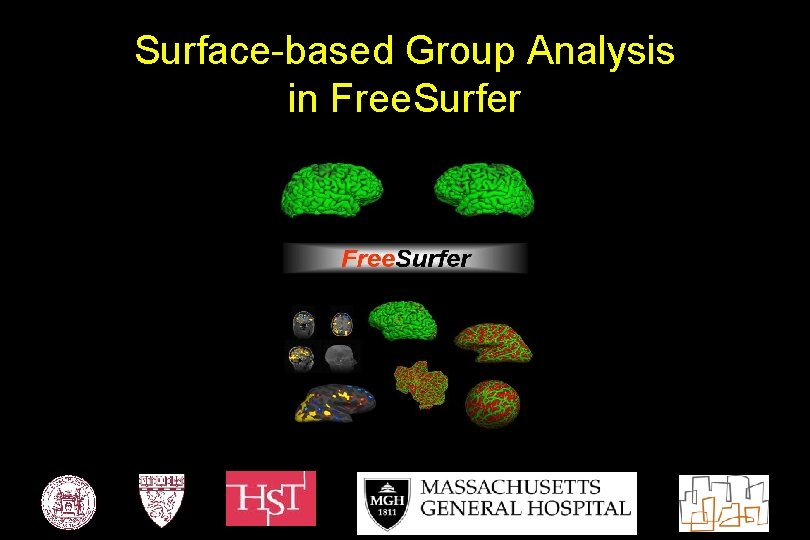 Surface-based Group Analysis in Free. Surfer 