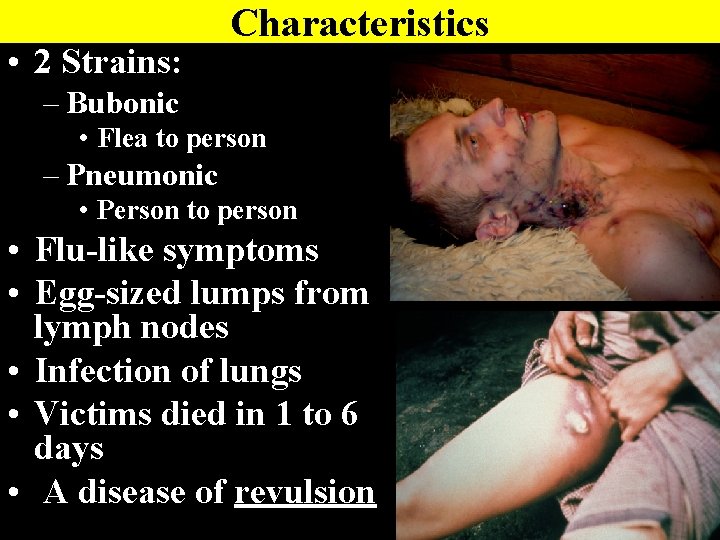  • 2 Strains: Characteristics – Bubonic • Flea to person – Pneumonic •
