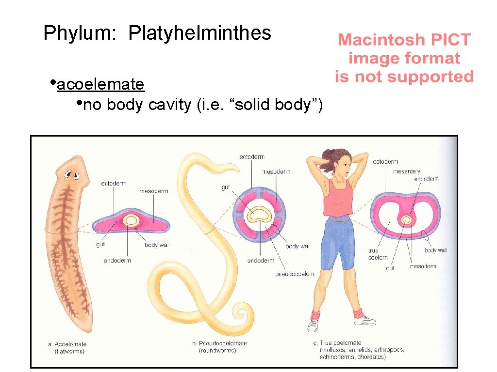 Radiata Metazoa Ancestral colonial flagellate Deuterostomia Eumetazoa ...