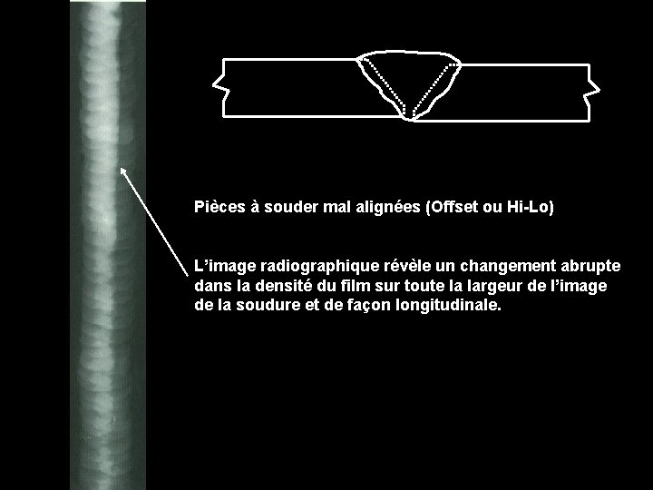Pièces à souder mal alignées (Offset ou Hi-Lo) L’image radiographique révèle un changement abrupte
