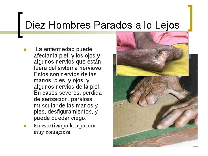 Diez Hombres Parados a lo Lejos n n “La enfermedad puede afectar la piel,