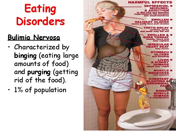 Eating Disorders Bulimia Nervosa • Characterized by binging (eating large amounts of food) and