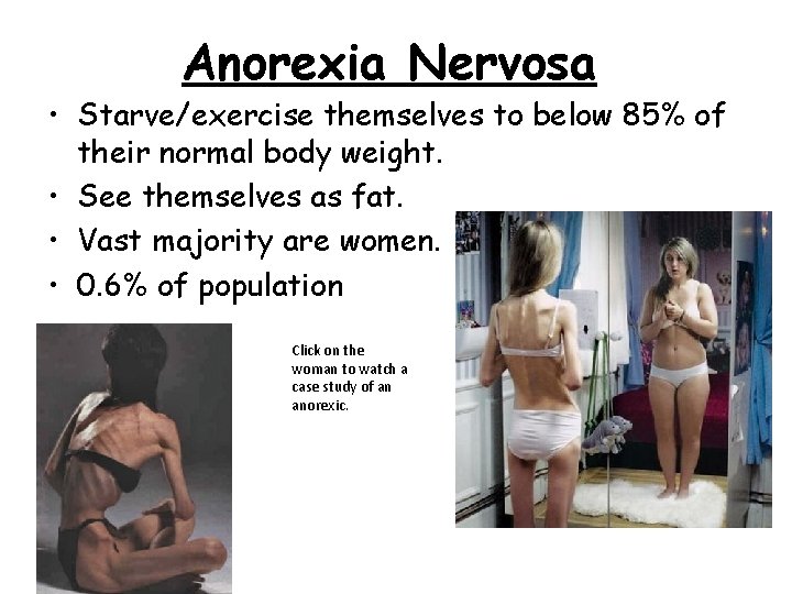 Anorexia Nervosa • Starve/exercise themselves to below 85% of their normal body weight. •
