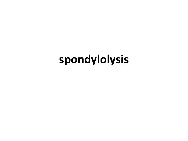 spondylolysis 