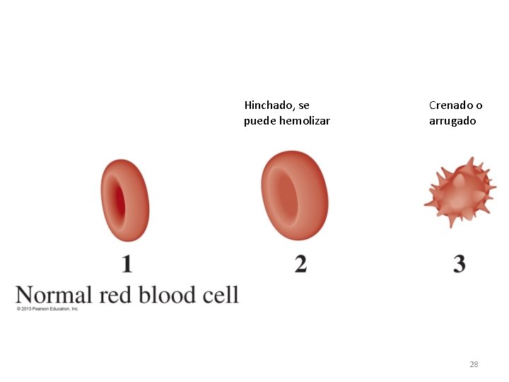 Hinchado, se puede hemolizar Crenado o arrugado 28 