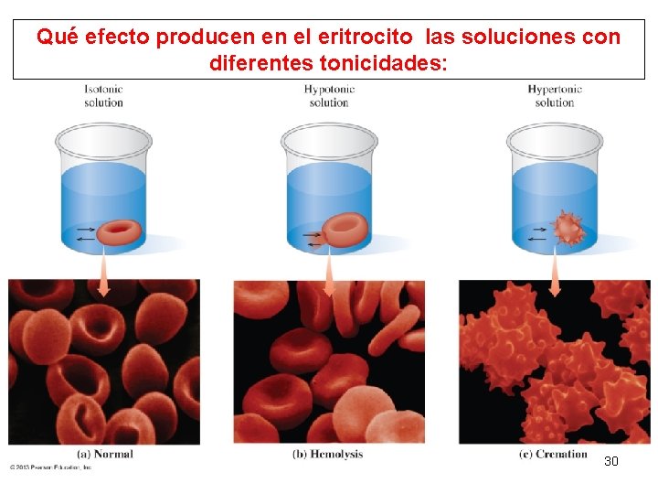 Qué efecto producen en el eritrocito las soluciones con diferentes tonicidades: 30 