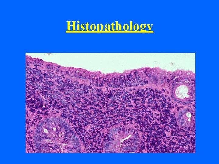 Histopathology 