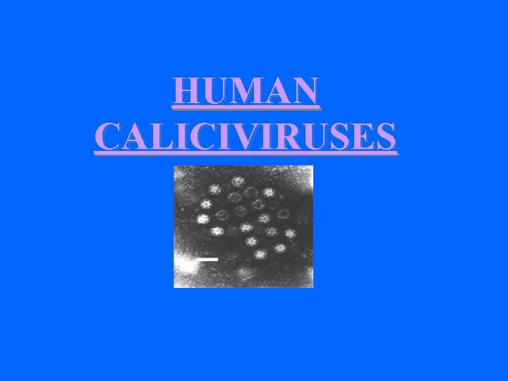 HUMAN CALICIVIRUSES 