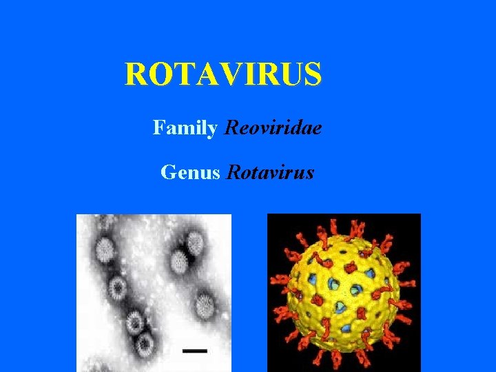 ROTAVIRUS Family Reoviridae Genus Rotavirus 