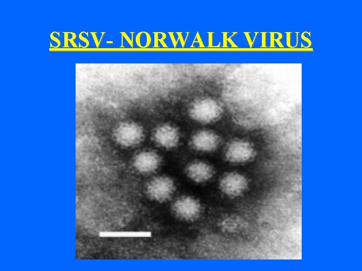 SRSV- NORWALK VIRUS 