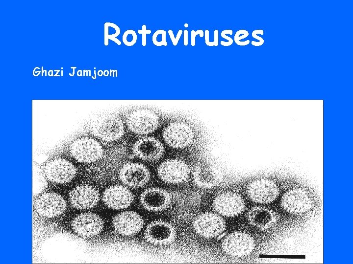 Rotaviruses Ghazi Jamjoom 