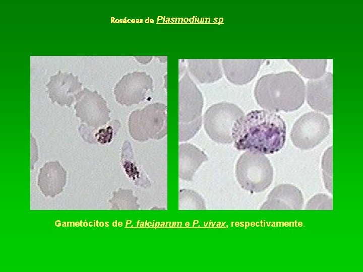 Rosáceas de Plasmodium sp Gametócitos de P. falciparum e P. vivax, respectivamente. 